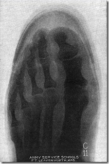 Munson X-Ray